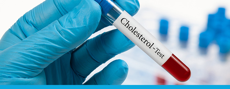 5 Tips To Lower Cholesterol