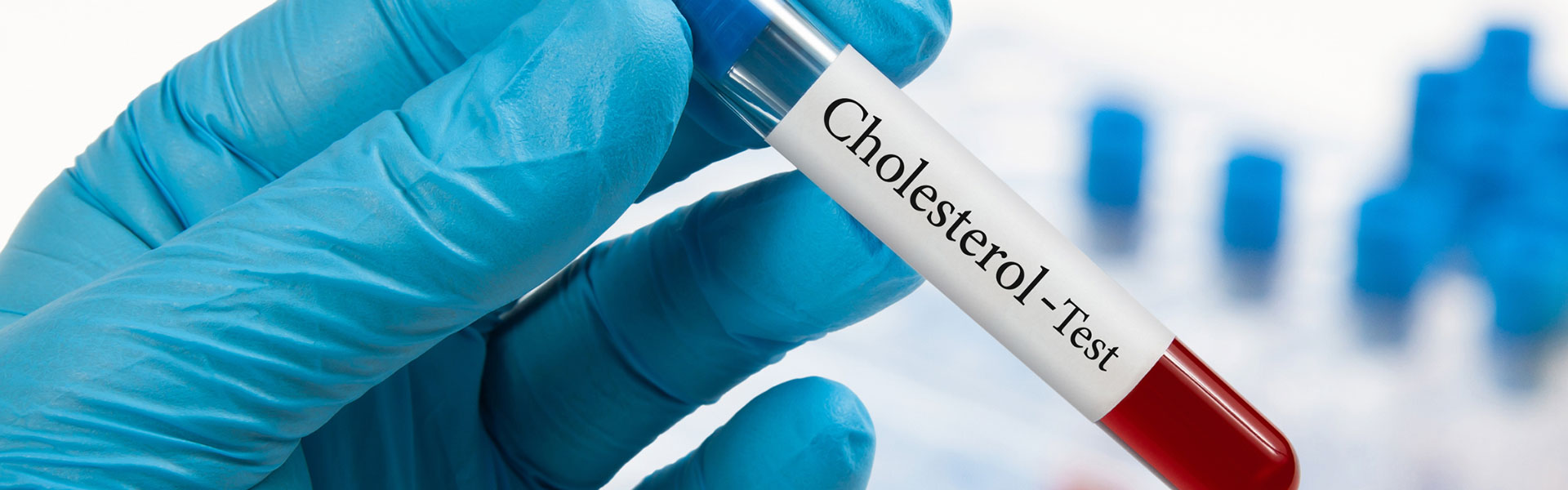 5 Tips To Lower Cholesterol